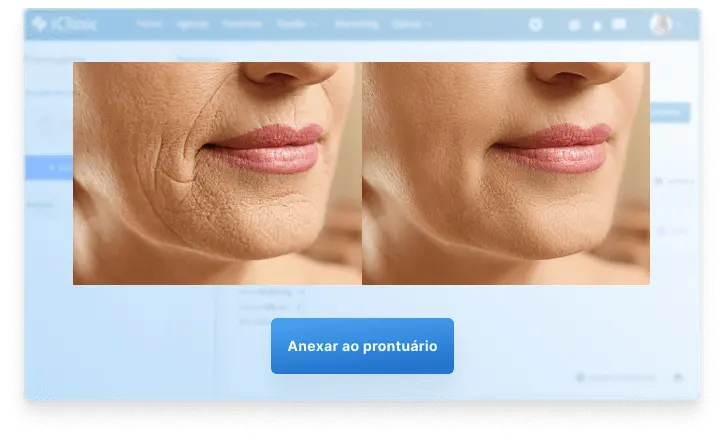 Tela: Comparação de imagens